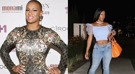 A before and after surgery picture of Nya Lee.